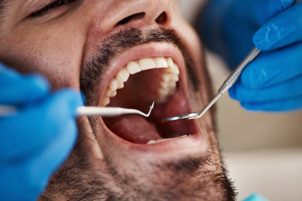 Best Walk-In Emergency Dentist in Gainesville, FL